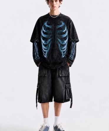X-Ray