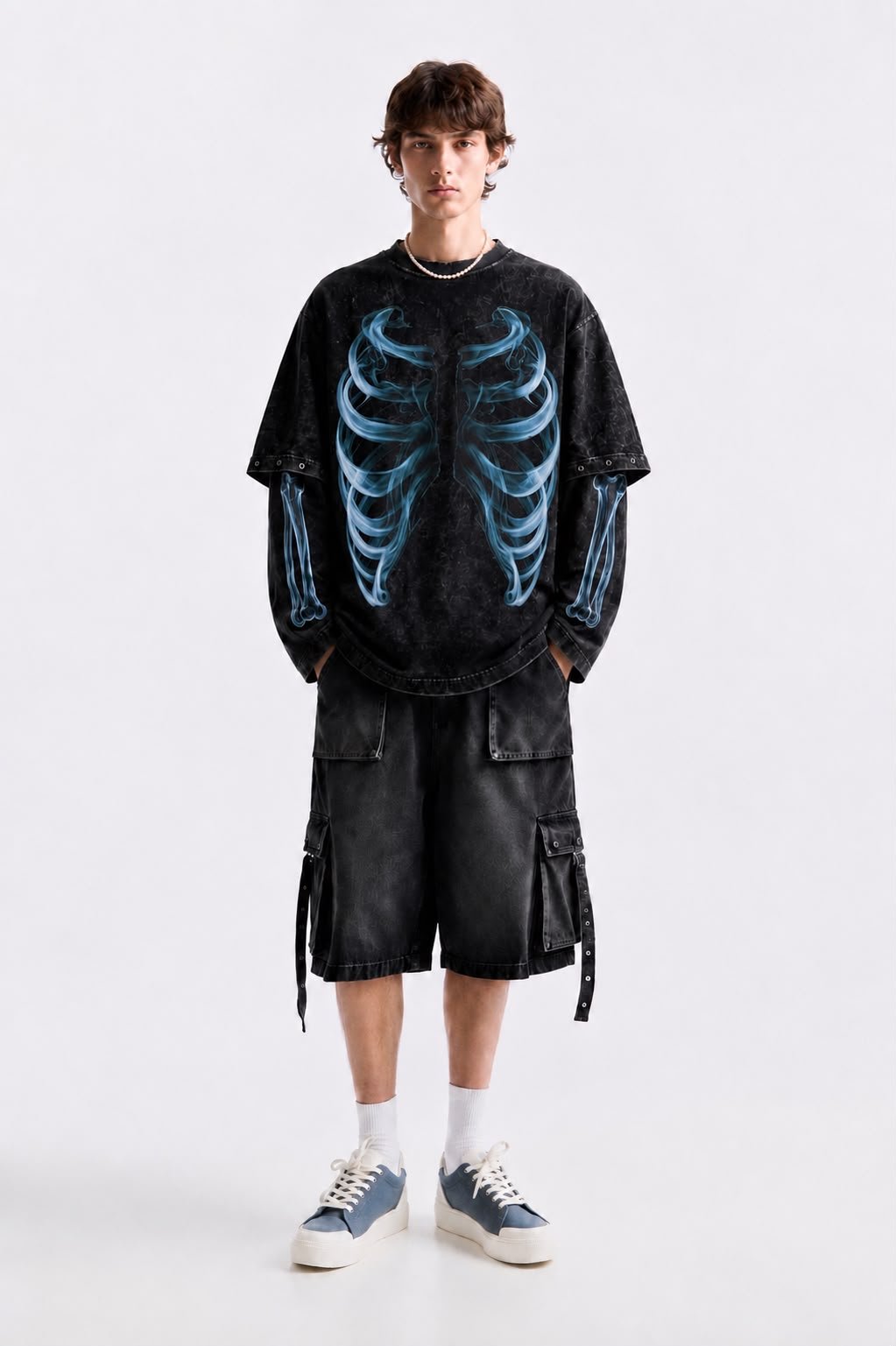 X-Ray